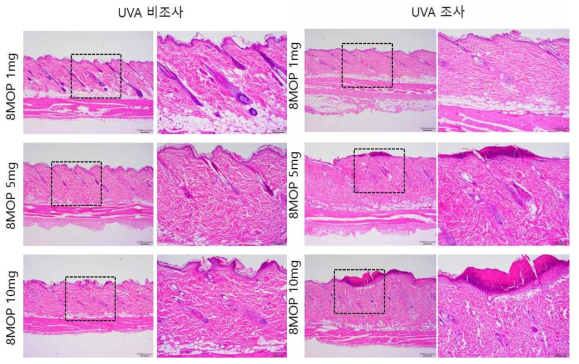 8-MOP 비조사군과 조사군의 H＆E 염색 결과