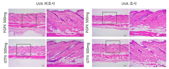 PGPS, GTFX 비조사군과 조사군의 H＆E 염색 결과