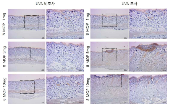 8-MOP 비조사군과 조사군의 면역염색 결과