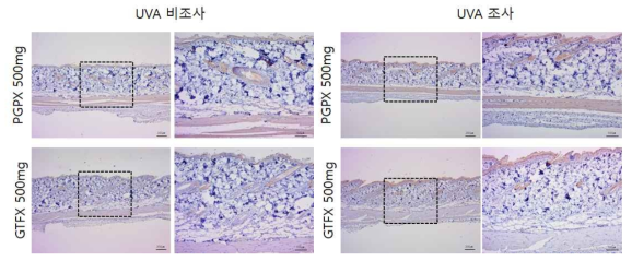 PGPS, GTFX 비조사군과 조사군의 면역염색 결과