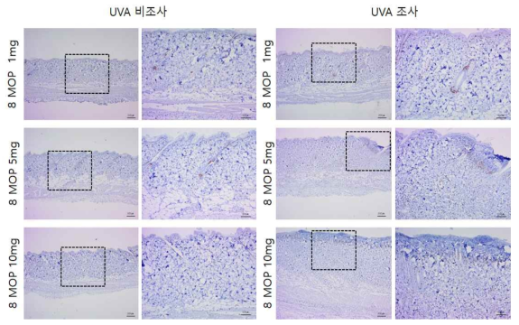 8-MOP 비조사군과 조사군의 면역염색 결과