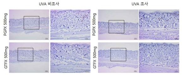 PGPS, GTFX 비조사군과 조사군의 면역염색 결과