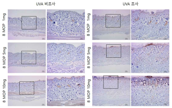 8-MOP 비조사군과 조사군의 면역염색 결과