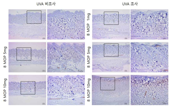 8-MOP 비조사군과 조사군의 면역염색 결과