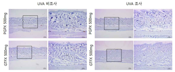 PGPS, GTFX 비조사군과 조사군의 면역염색 결과