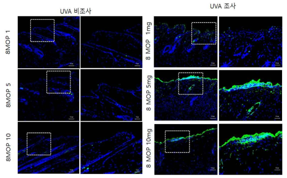 8-MOP 비조사군과 조사군의 면역염색 결과