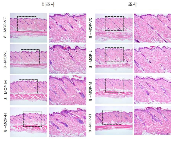 8-MOP 비조사군과 조사군의 H＆E 염색 결과