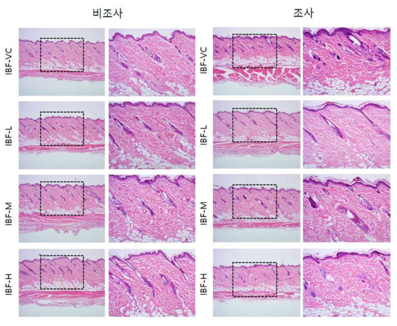 IBF 비조사군과 조사군의 H＆E 염색 결과