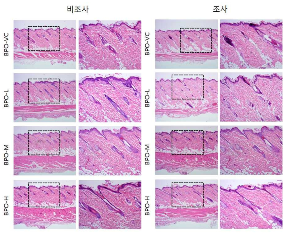 BPO 비조사군과 조사군의 H＆E 염색 결과