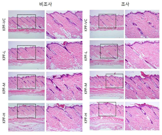 KPF 비조사군과 조사군의 H＆E 염색 결과