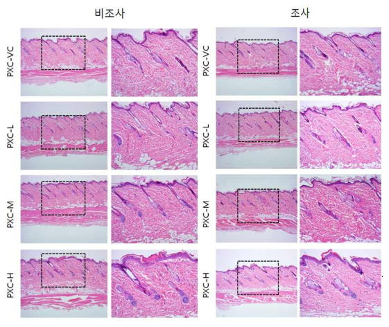 PXC 비조사군과 조사군의 H＆E 염색 결과