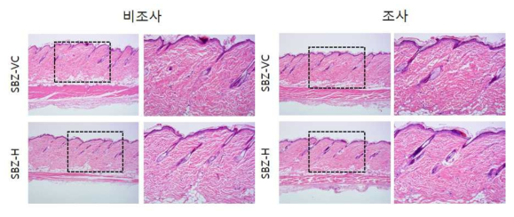 SBZ 비조사군과 조사군의 H＆E 염색 결과