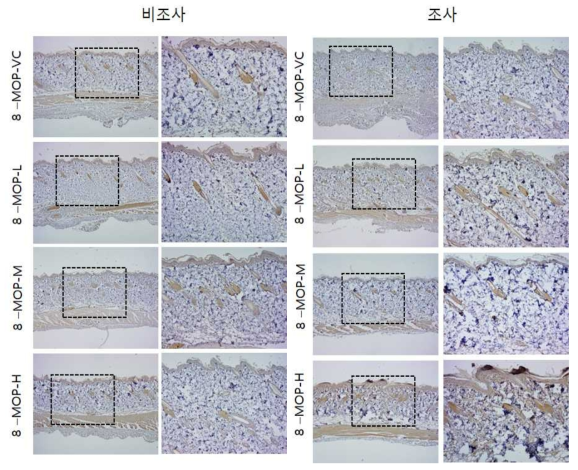 8-MOP 비조사군과 조사군의 면역염색 결과