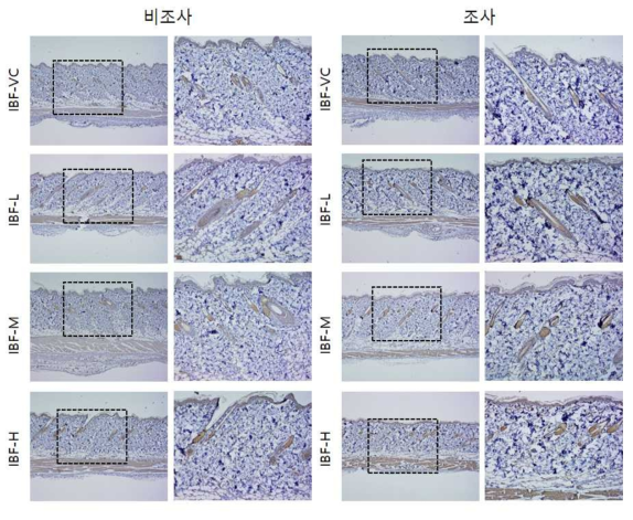 IBF 비조사군과 조사군의 면역염색 결과