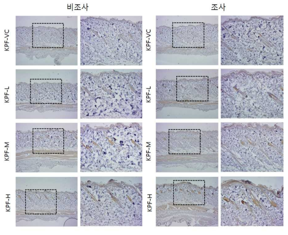 KPF 비조사군과 조사군의 면역염색 결과