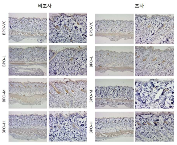 BPO 비조사군과 조사군의 면역염색 결과