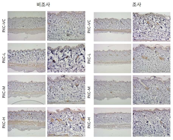 PXC 비조사군과 조사군의 면역염색 결과