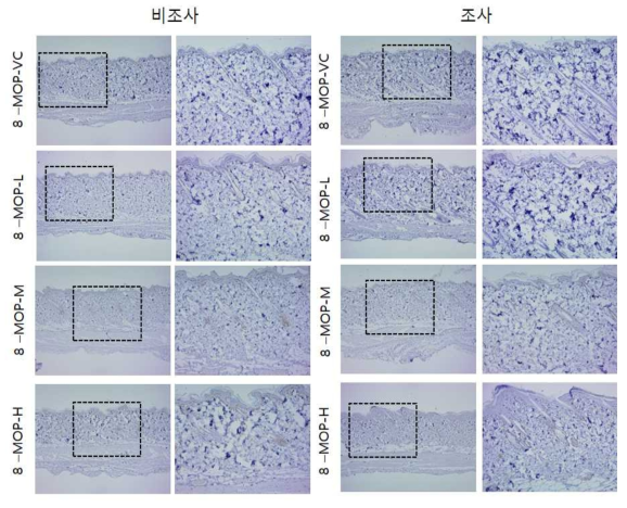8-MOP 비조사군과 조사군의 면역염색 결과