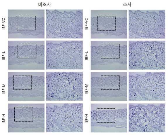 IBF 비조사군과 조사군의 면역염색 결과