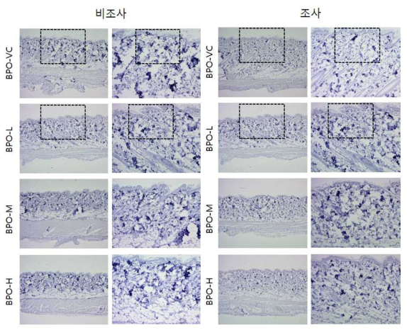 BPO 비조사군과 조사군의 면역염색 결과