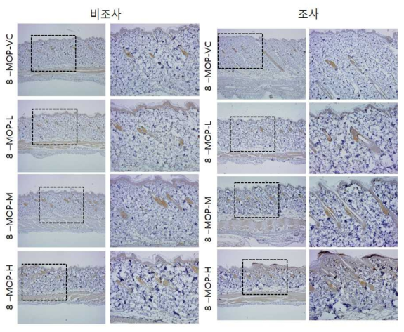 8-MOP 비조사군과 조사군의 면역염색 결과