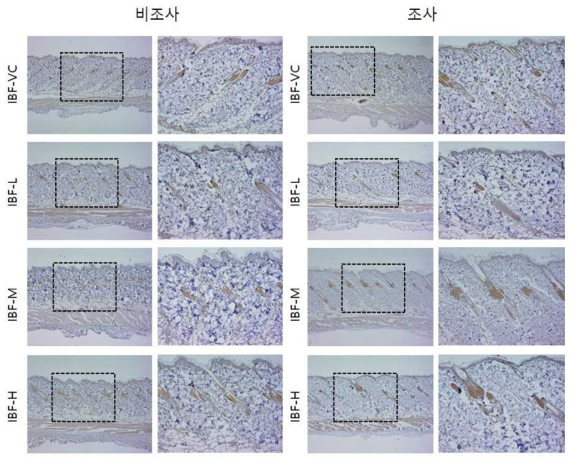 IBF 비조사군과 조사군의 면역염색 결과