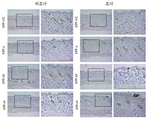 KPF 비조사군과 조사군의 면역염색 결과