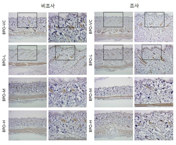 BPO 비조사군과 조사군의 면역염색 결과