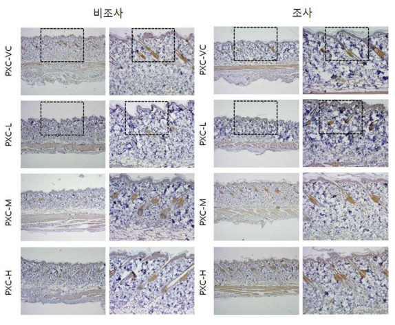 PXC 비조사군과 조사군의 면역염색 결과
