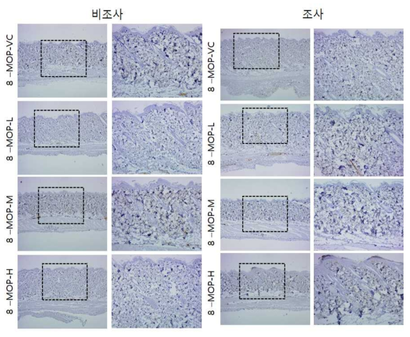8-MOP 비조사군과 조사군의 면역염색 결과