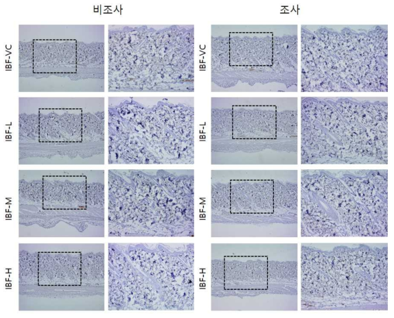 IBF 비조사군과 조사군의 면역염색 결과