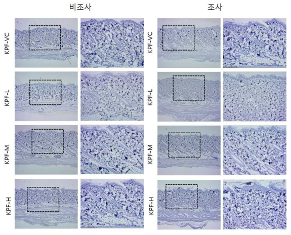 KPF 비조사군과 조사군의 면역염색 결과