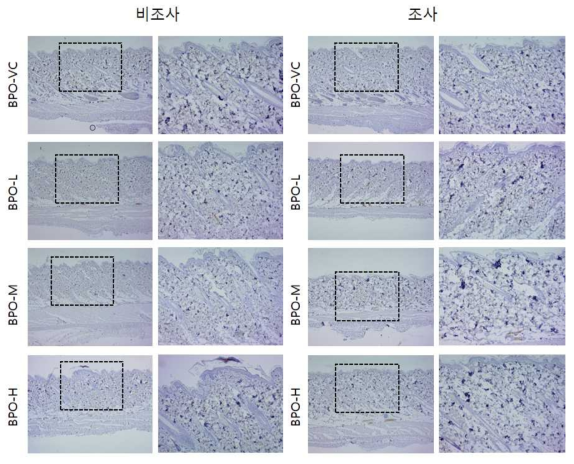 BPO 비조사군과 조사군의 면역염색 결과