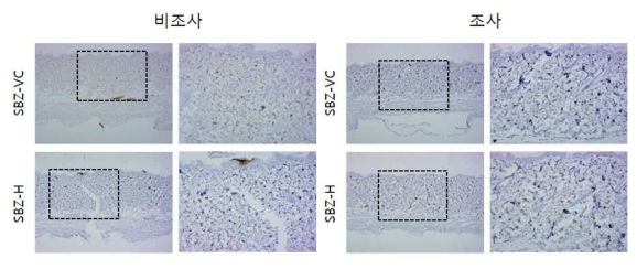SBZ 비조사군과 조사군의 면역염색 결과