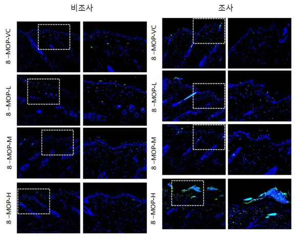 8-MOP 비조사군과 조사군의 면역염색 결과