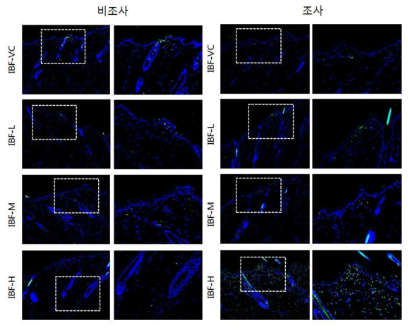 IBF 비조사군과 조사군의 면역염색 결과
