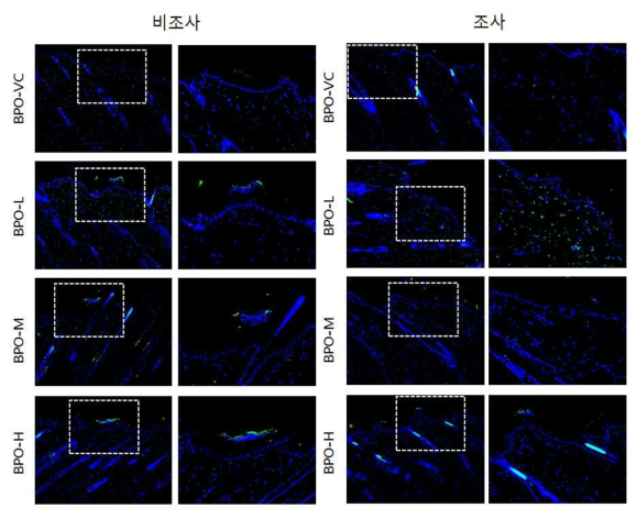 BPO 비조사군과 조사군의 면역염색 결과