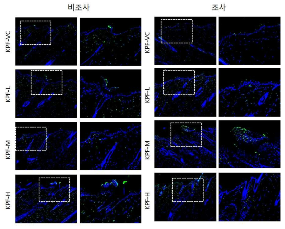 KPF 비조사군과 조사군의 면역염색 결과