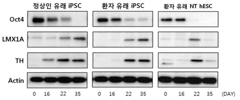 정상인 유래 iPSC와 환자 유래 iPSC, 환자유래 NT hESC의 분화 초기 발현량 확인