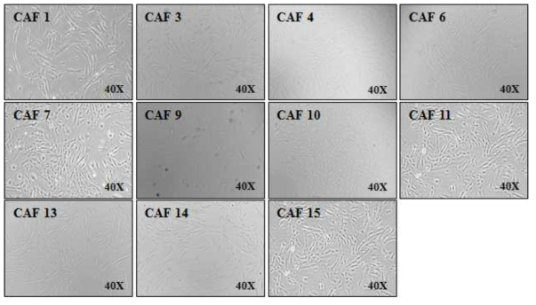구축한 CAF 불멸화 세포주