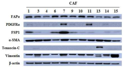 Western blotting을 통해 확인한 CAF 마커 단백질의 발현