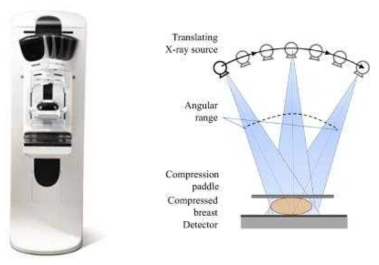 Tomosynthesis의 외형 및 시스템 개략도
