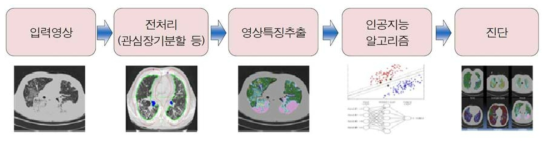 의료영상에서 인공지능 알고리즘 적용을 위한 과정 * 출처: 정보통신기술진흥센터, 의료영상에서의 인공지능 연구 동향(주간기술동향 2016.5.25)