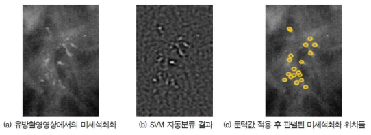 유방촬영영상에서의 미세석회화 SVM 기반 자동분류 결과 * 출처: 정보통신기술진흥센터, 의료영상에서의 인공지능 연구 동향(주간기술동향 2016.5.25)