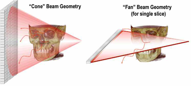 CBCT와 일반 CT의 촬영방법 비교 *출처: Wiliam C. Scarfe et al, What is Cone-Beam CT and How Does it Work?(2008)