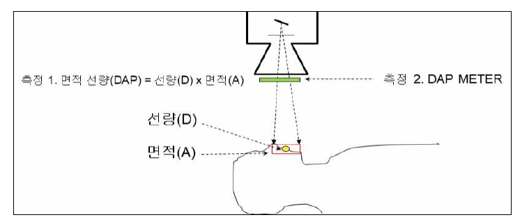 면적선량 측정 예