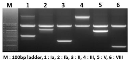 GBS 혈청형별 PCR 결과