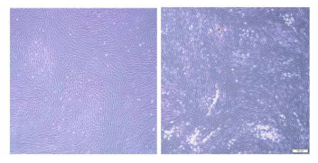 MRC-5 세포 이미지(좌) 정상세포(우) 바이러스 감염 후 70% CPE를 보이는 VZV 감염세포