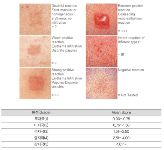 국제접촉피부염연구회의 판정기준