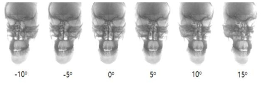 X-선 조사 각도별 평면 영상